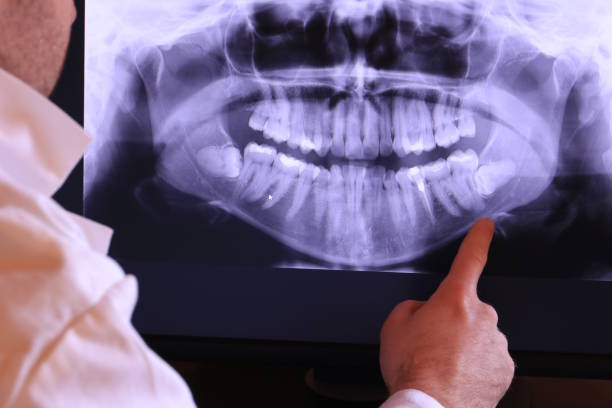 Best Emergency Treatment for Toothache in Portland, IN