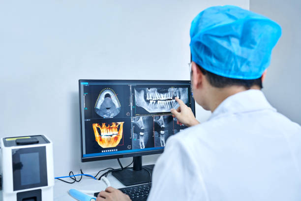 Best Emergency Wisdom Teeth Removal in Portland, IN